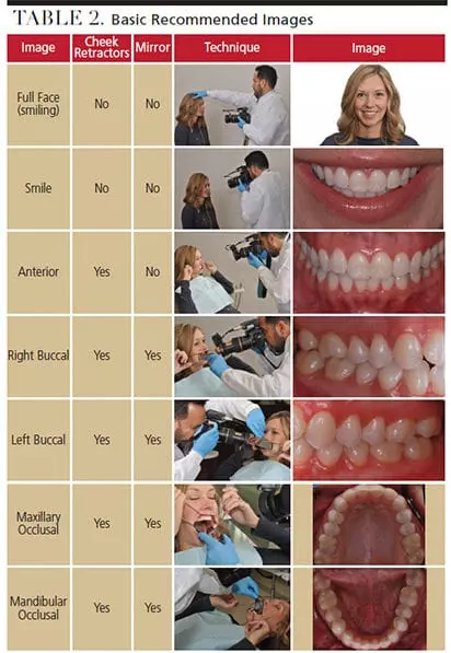 نحوه گرفتن عکس دندانپزشکی